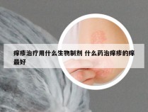 痒疹治疗用什么生物制剂 什么药治痒疹的痒最好