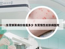 东莞银屑病价格是多少 东莞慢性皮肤病医院