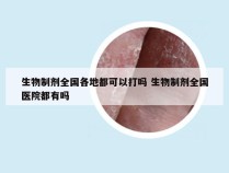 生物制剂全国各地都可以打吗 生物制剂全国医院都有吗