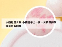 小孩肚皮长癣 小孩肚子上一片一片的像藓发痒是怎么回事