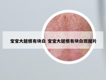 宝宝大腿根有块白 宝宝大腿根有块白斑图片