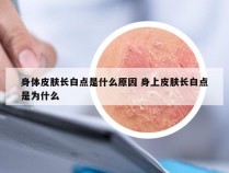 身体皮肤长白点是什么原因 身上皮肤长白点是为什么