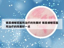 银屑病哪家医院治疗的效果好 银屑病哪家医院治疗的效果好一点