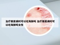 治疗银屑病时可以吃海鲜吗 治疗银屑病时可以吃海鲜吗女性