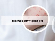 癣痒皮毒清的功效 癣痒清价格