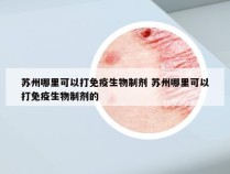 苏州哪里可以打免疫生物制剂 苏州哪里可以打免疫生物制剂的