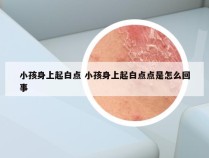 小孩身上起白点 小孩身上起白点点是怎么回事