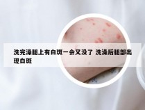 洗完澡腿上有白斑一会又没了 洗澡后腿部出现白斑