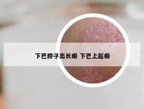 下巴脖子出长癣 下巴上起癣