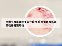 疗癣卡西甫丸吃多久一疗程 疗癣卡西甫丸饭前吃还是饭后吃