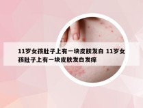 11岁女孩肚子上有一块皮肤发白 11岁女孩肚子上有一块皮肤发白发痒