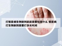 打银屑病生物制剂前前需要检查什么 银屑病打生物制剂需要打多长时间