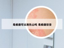 毒癣康可以用伤口吗 毒癣康软膏