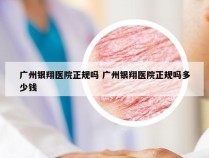 广州银翔医院正规吗 广州银翔医院正规吗多少钱