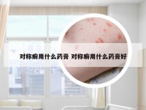 对称癣用什么药膏 对称癣用什么药膏好