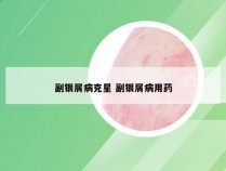 副银屑病克星 副银屑病用药