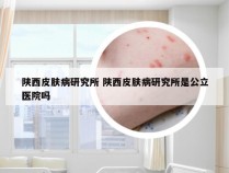 陕西皮肤病研究所 陕西皮肤病研究所是公立医院吗