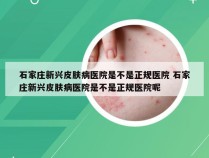 石家庄新兴皮肤病医院是不是正规医院 石家庄新兴皮肤病医院是不是正规医院呢