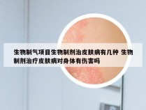 生物制气项目生物制剂治皮肤病有几种 生物制剂治疗皮肤病对身体有伤害吗