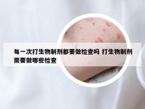 每一次打生物制剂都要做检查吗 打生物制剂需要做哪些检查