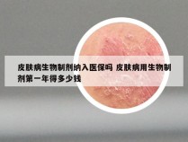 皮肤病生物制剂纳入医保吗 皮肤病用生物制剂第一年得多少钱