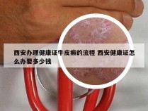 西安办理健康证牛皮癣的流程 西安健康证怎么办要多少钱