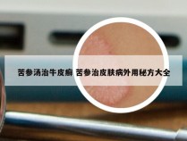 苦参汤治牛皮癣 苦参治皮肤病外用秘方大全