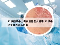 11岁孩子手上有白点是怎么回事 11岁手上有红点怎么回事