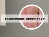 生物制剂打完会发胖吗 生物制剂打了还是疼