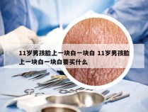 11岁男孩脸上一块白一块白 11岁男孩脸上一块白一块白要买什么