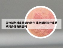 生物制剂对皮肤病的条件 生物制剂治疗皮肤病对身体有伤害吗