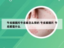 牛皮廨图片牛皮廨怎么得的 牛皮廨图片 牛皮廨是什么