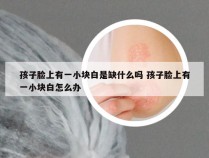 孩子脸上有一小块白是缺什么吗 孩子脸上有一小块白怎么办