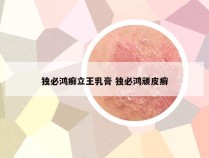 独必鸿癣立王乳膏 独必鸿顽皮癣