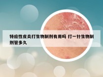 特应性皮炎打生物制剂有用吗 打一针生物制剂管多久