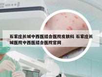 石家庄长城中西医结合医院皮肤科 石家庄长城医院中西医结合医院官网