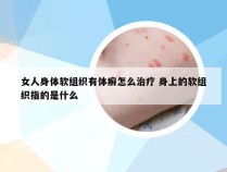 女人身体软组织有体癣怎么治疗 身上的软组织指的是什么