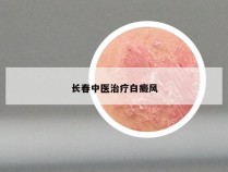 长春中医治疗白癜风