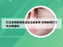 打过生物制剂拓咨后注意事项 生物制剂打了可以喝酒吗