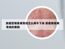 脓疱型银屑病发烧怎么降不下来 脓疱银屑病发烧的原因