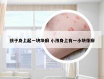 孩子身上起一块块癣 小孩身上有一小块像癣