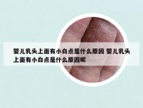 婴儿乳头上面有小白点是什么原因 婴儿乳头上面有小白点是什么原因呢