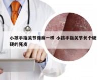 小孩手指关节像癣一样 小孩手指关节长个硬硬的死皮