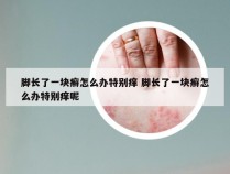 脚长了一块癣怎么办特别痒 脚长了一块癣怎么办特别痒呢