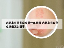 大腿上有很多白点是什么原因 大腿上有白色点点是怎么回事