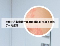 小腹下方长癣是什么原因引起的 小腹下面长了一片疙瘩