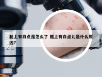 腿上有白点是怎么了 腿上有白点儿是什么原因?