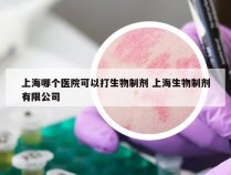 上海哪个医院可以打生物制剂 上海生物制剂有限公司