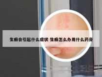 生癣会引起什么症状 生癣怎么办用什么药膏