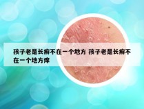 孩子老是长癣不在一个地方 孩子老是长癣不在一个地方痒